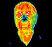 figure 1A