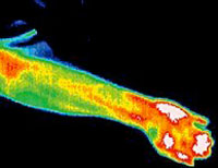 figure 1A